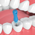 Understanding Endodontics